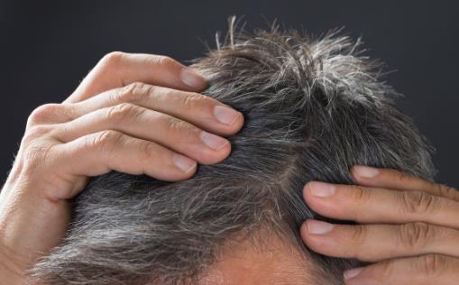 為什么有些人的頭發(fā)兩鬢會先白