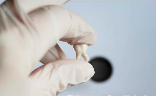 智齒發(fā)炎的5種療法 拔智齒的影響和風(fēng)險(xiǎn)