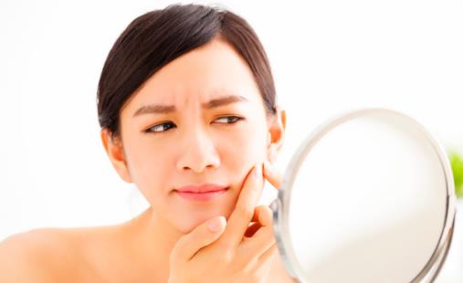 預防青春痘的4個方法