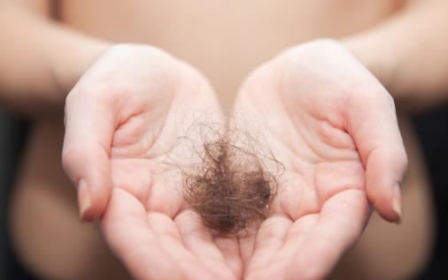 脫發人群注意了 5種食物可促進頭發生長