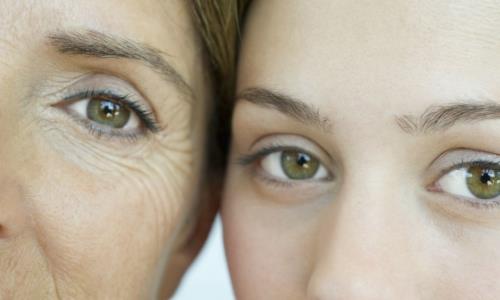 經(jīng)常笑容易長(zhǎng)眼尾紋嗎 魚尾紋該如何去除