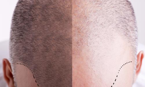 頭發(fā)少要怎么保養(yǎng)？四個(gè)問(wèn)題要注意