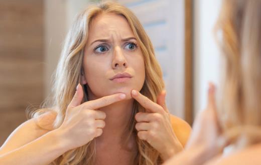 易生痘痘的人 去除痤瘡產生的印記小妙招