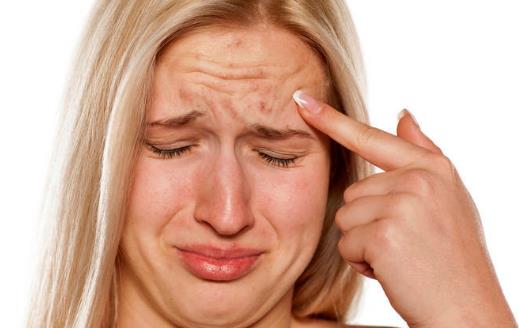 肌膚長(zhǎng)痘痘 祛痘10大誤區(qū)應(yīng)避免