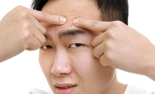 肌膚長(zhǎng)痘痘 祛痘10大誤區(qū)應(yīng)避免