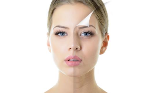 臉上出現紅血絲的原因 8種方法來改善