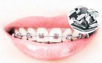 武漢德韓口腔真相大揭秘，金屬矯正的過程會不會很疼？
