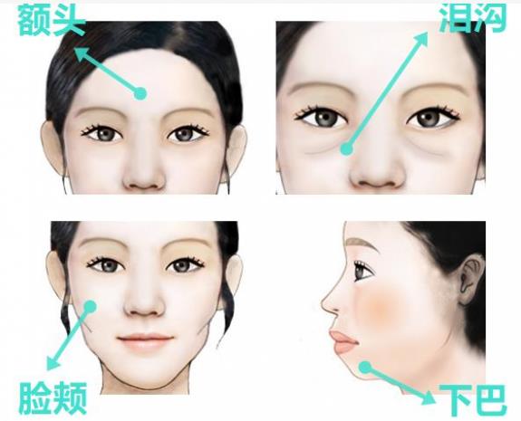 韋元強講解:瘦子也適合做自體脂肪填充嗎?