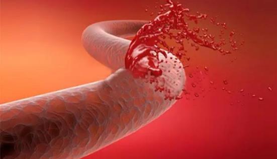 北京彤美整形醫院桂行軍科普:鼻整形術后飲食需要注意什么