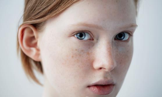 經常化妝 臉上長斑怎么辦？