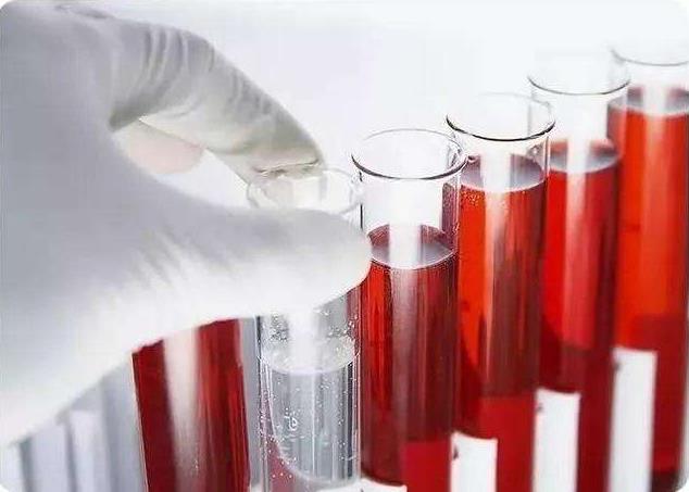 青島靜康醫(yī)院案例：明明是重度腎衰,血肌酐卻正常!化驗(yàn)單會說謊嗎?