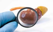 青島靜康醫(yī)院案例：明明是重度腎衰,血肌酐卻正常!化驗(yàn)單會說謊嗎?