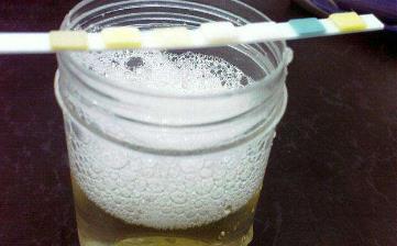 【尿泡沫】尿泡沫多是怎么回事_尿泡沫多散不干凈的原因_尿泡沫到尿毒癥