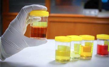 【尿液黃】尿液黃是什么原因_尿液發黃而渾濁是怎么回事_長期尿黃是什么病 【尿液黃】尿液黃是什么原因_尿液發黃而渾濁是怎么回事_長期尿黃是什么病