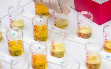 【尿液發黃】尿液發黃有異味是怎么回事_尿液發黃泡沫多_尿液特別黃的原因