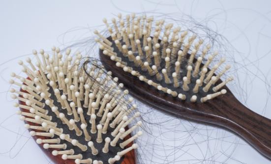 OMG!產(chǎn)后脫發(fā)這么嚴(yán)重嗎?