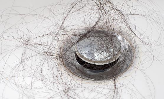 OMG!產(chǎn)后脫發(fā)這么嚴(yán)重嗎?