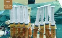 北京潤美玉之光張紅芳丨自體脂肪精度填充，在細節上提升效果