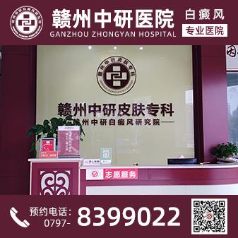 贛州白癜風醫院離火車站多遠 疫情期間白癜風患者怎么提高免疫力