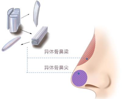 北京圣慈整形醫院鼻子王王軍怎么樣?專業實力 讓你放心美
