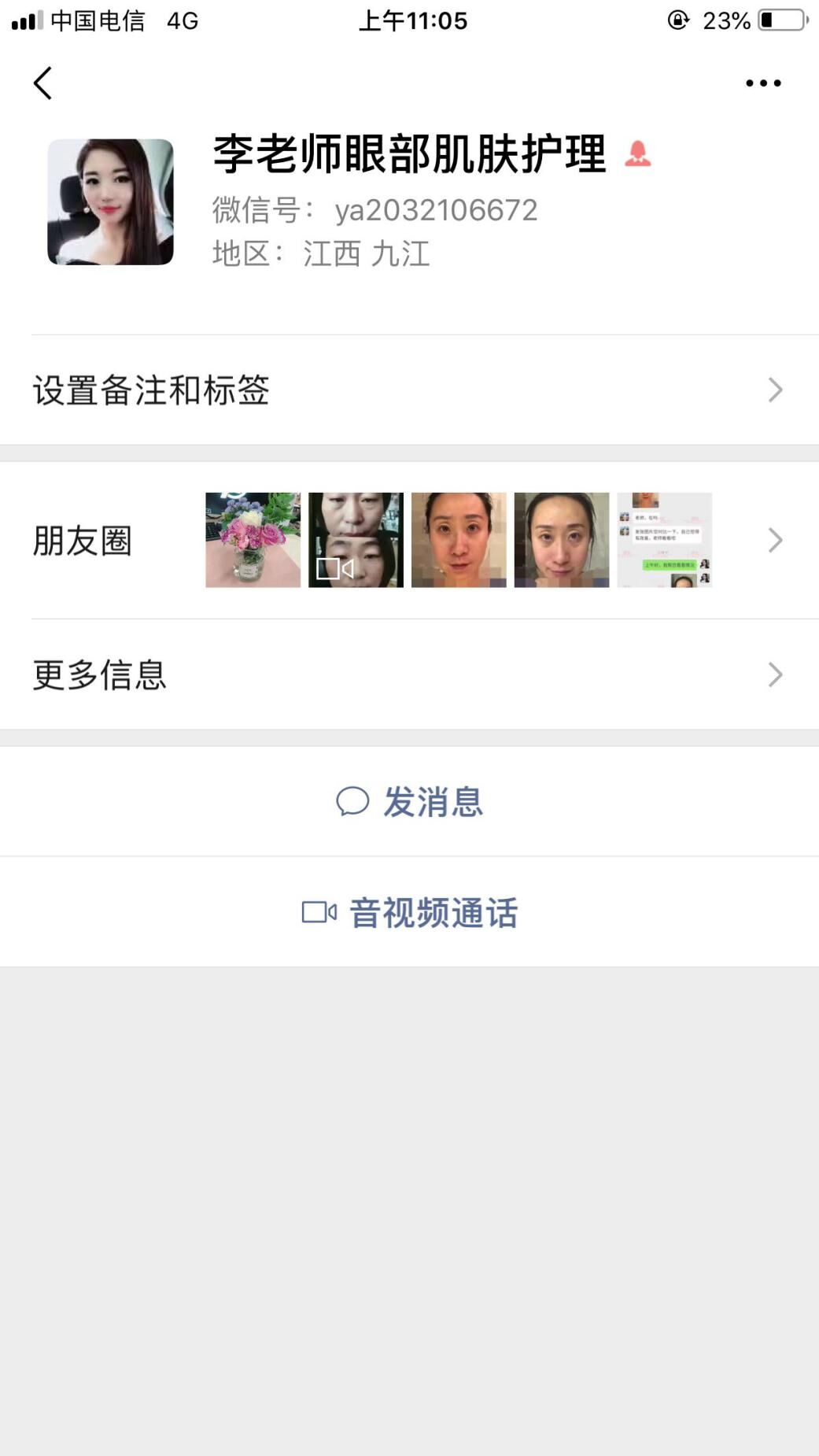衛婭日記:我一直都以為眼袋對我的影響只是美觀,直到我了解了以后……