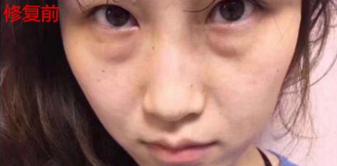 衛婭日記:我一直都以為眼袋對我的影響只是美觀,直到我了解了以后……