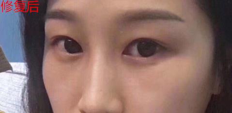 衛婭日記:我一直都以為眼袋對我的影響只是美觀,直到我了解了以后……