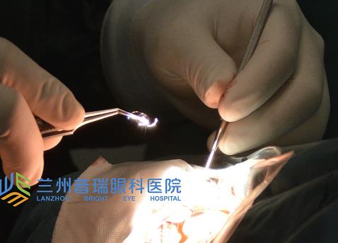 蘭州普瑞眼科治療白內(nèi)障怎么樣？預(yù)防白內(nèi)障從年輕開始