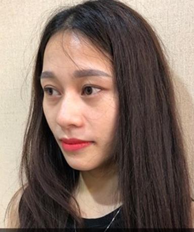 君雅筆記：眼袋過重，就會顯得比真實年齡大，要如何修復眼袋呢？