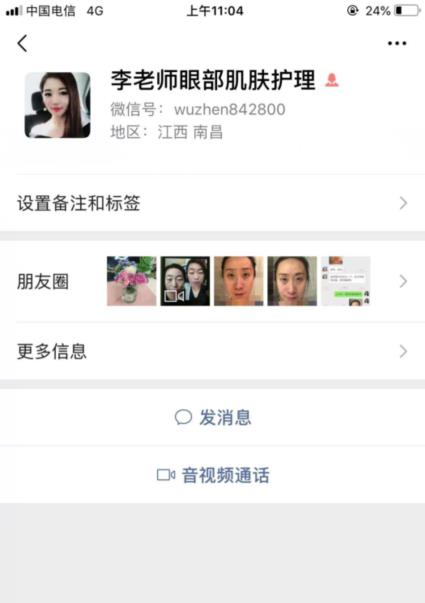 君雅筆記：眼袋過重，就會顯得比真實年齡大，要如何修復眼袋呢？