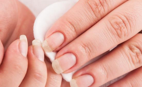 洗甲水日常妙用多 使用洗甲水的注意事項分享