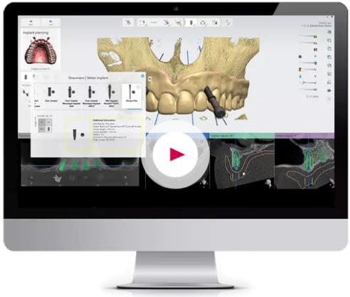 中家醫口腔全民愛牙公益行動：德國智能種植牙更靠譜