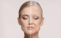 肌美人蔓越莓膠原蛋白肽，阻擊自然老化，恢復年輕體態