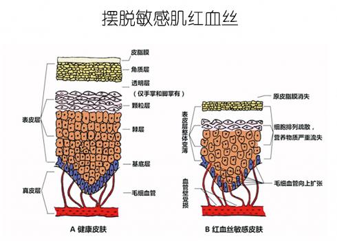 放心！有美薏升修復(fù)敏感肌紅血絲專家產(chǎn)品在，你每天都可以美美噠