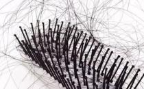 ?女性白領改善脫發問題 推薦10款食譜防脫發