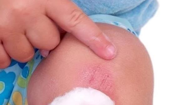 一不留神寶寶受傷了 父母鎮定處理好方法