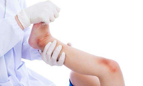 一不留神寶寶受傷了 父母鎮定處理好方法